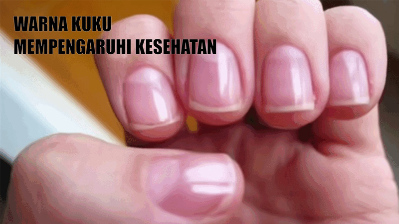 Perubahan Warna Kuku yang Mengindikasikan Masalah Kesehatan – PAFI Kota Agung